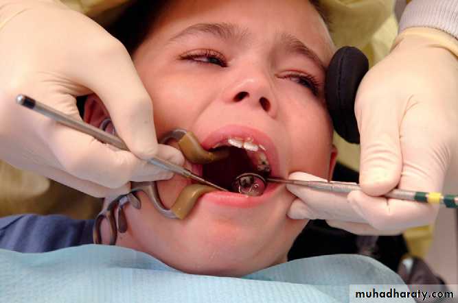 dental care of children with special needs