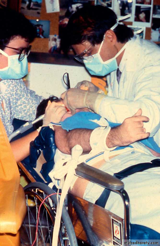 dental care of children with special needs