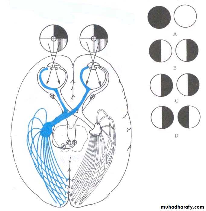 Cranial Nerves