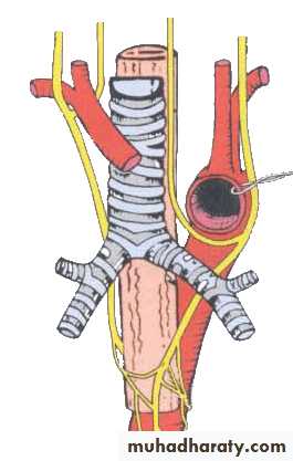 Cranial Nerves
