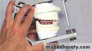 Interocclusal Record