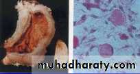 ovary