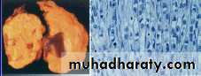 ovary