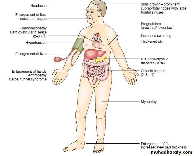 Hyperprolactinemia
