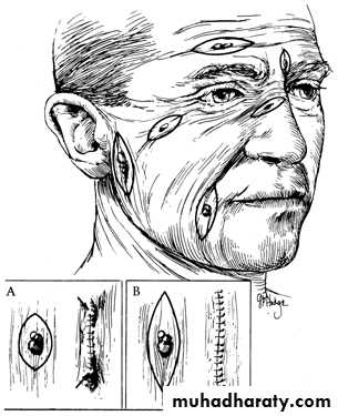 Principles of plastic surgery