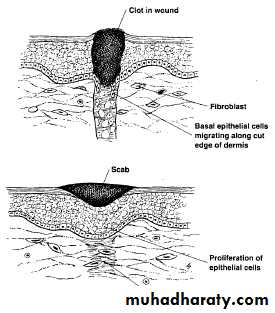 Principles of plastic surgery