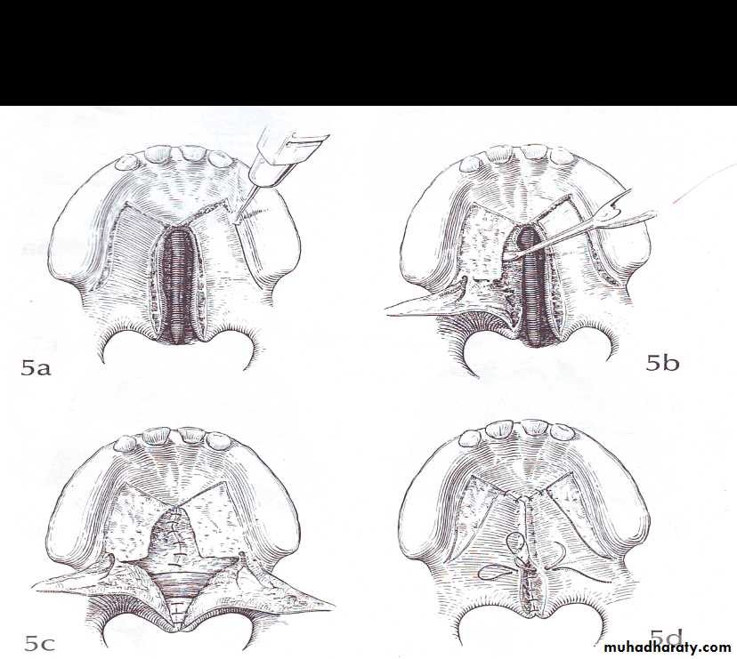 Principles of plastic surgery