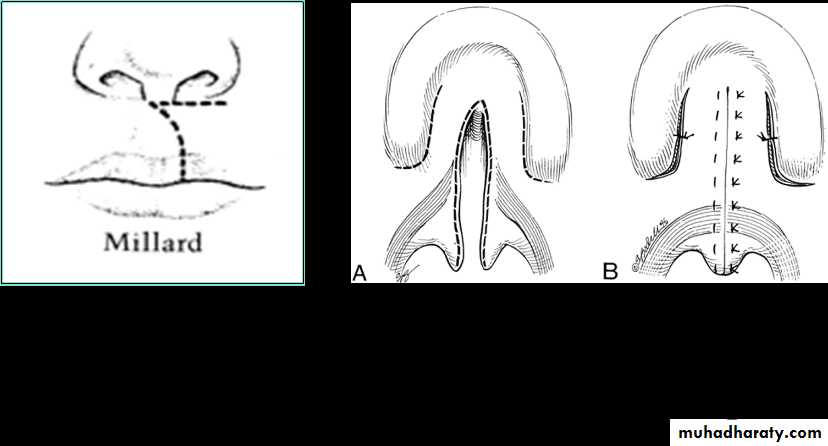 Principles of plastic surgery