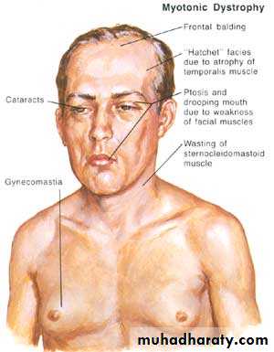 DISEASES OF THE MUSCLES