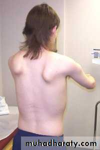 Disease of the muscle