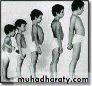 Disease of the muscle
