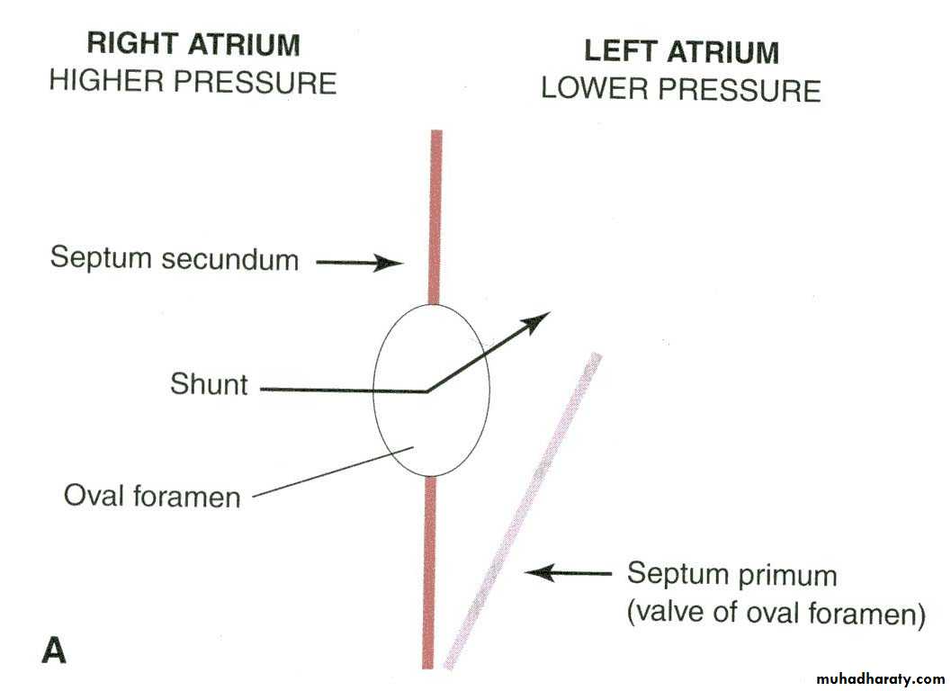 Cardiovascular System ppt