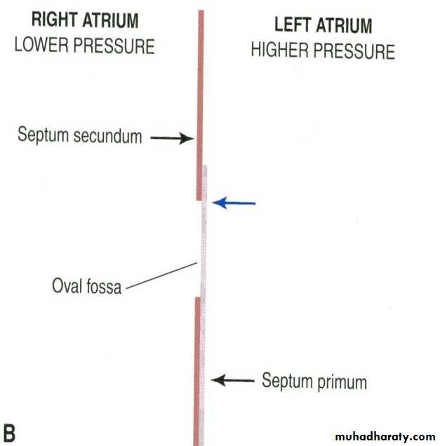 Cardiovascular System ppt