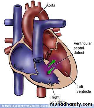 Cardiovascular System ppt
