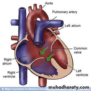 Cardiovascular System ppt