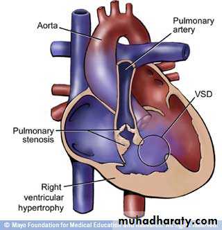 Cardiovascular System ppt