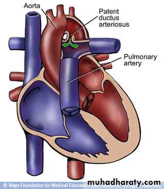 Cardiovascular System ppt