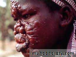 mycobacterium