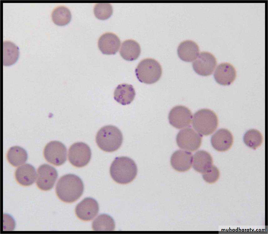 mycobacterium