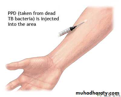 mycobacterium