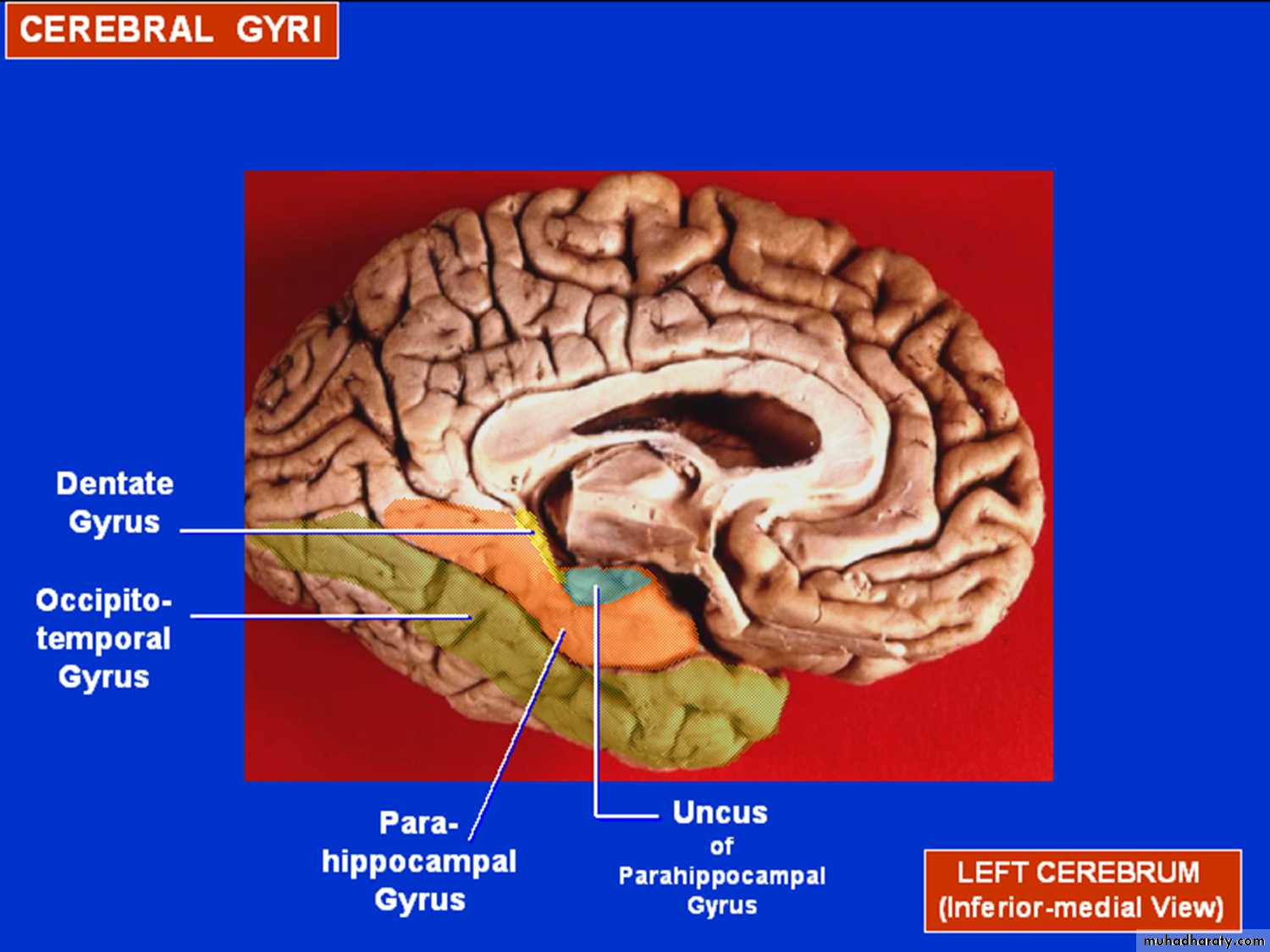 Brain