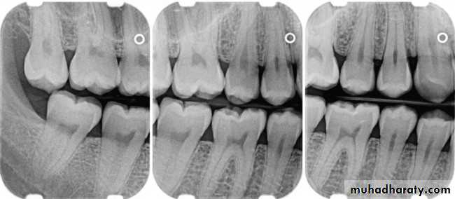 lec.3Alveolar Process (Bone)