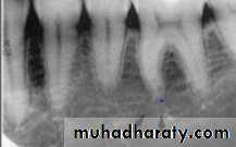 lec.3Alveolar Process (Bone)