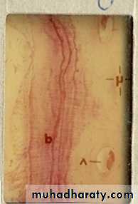 lec.3Alveolar Process (Bone)