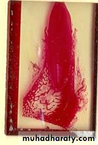 lec.3Alveolar Process (Bone)