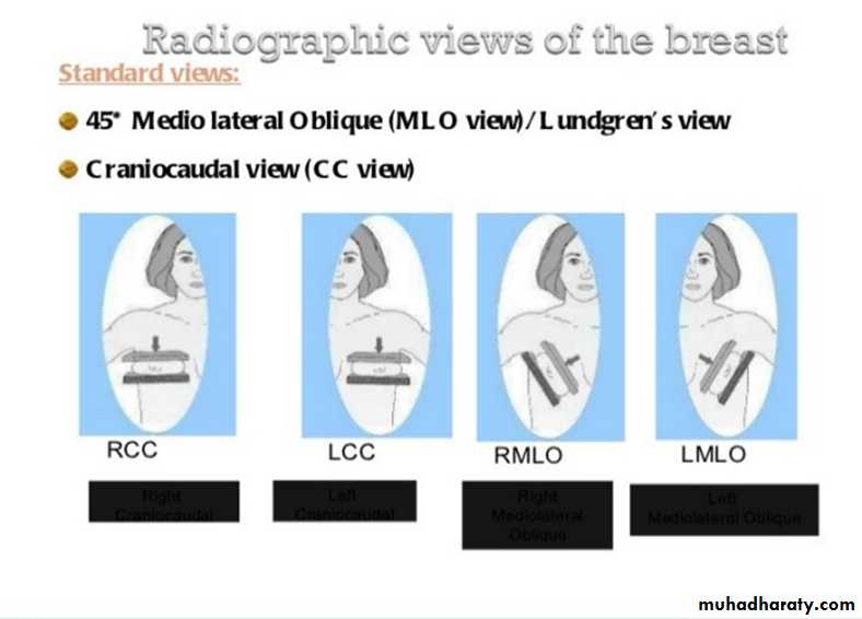 mammogram