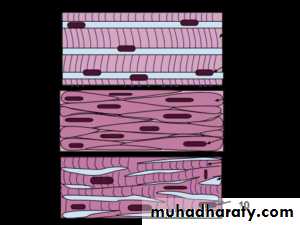 type of the tissues