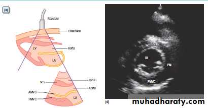 Medical terminology lecture 1