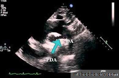 The cardiovascular system
