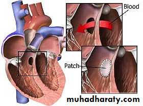 The cardiovascular system