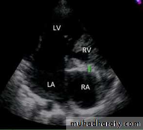 The cardiovascular system