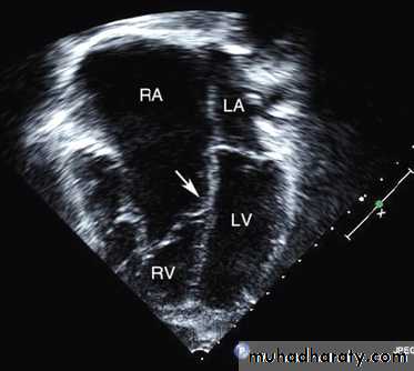 The cardiovascular system