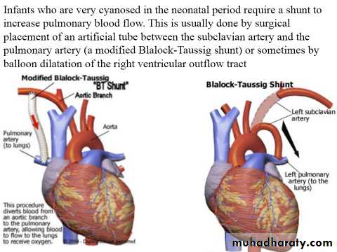 The cardiovascular system