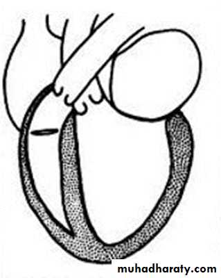 The cardiovascular system