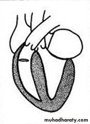 The cardiovascular system