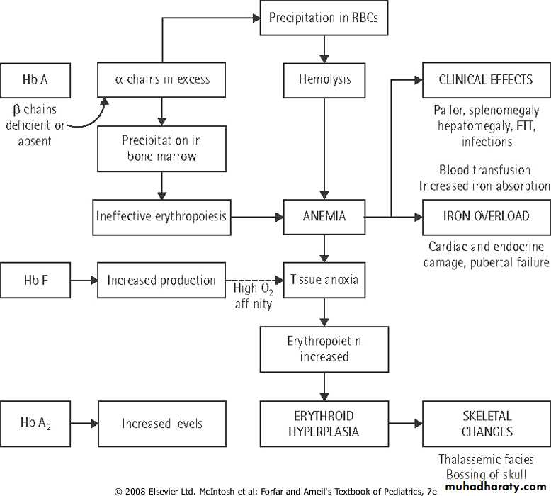 thalassemia