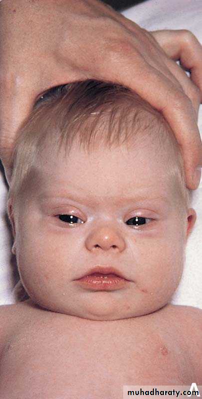 Oncologic Diseases