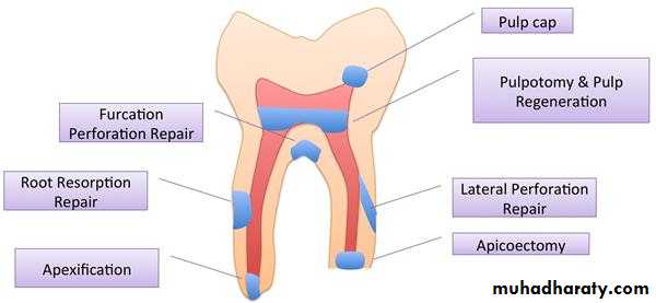 Pulp protection