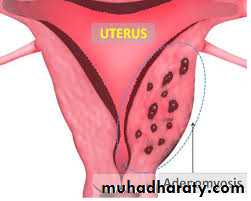 History and examination in Gynecology