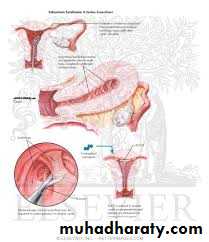 History and examination in Gynecology