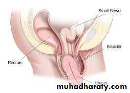 History and examination in Gynecology