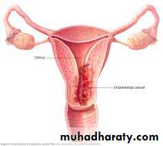 History and examination in Gynecology