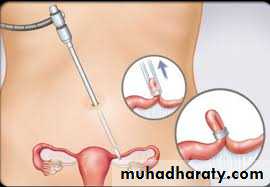 History and examination in Gynecology