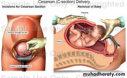 History and examination in Gynecology