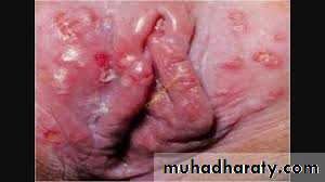 History and examination in Gynecology