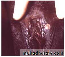 History and examination in Gynecology